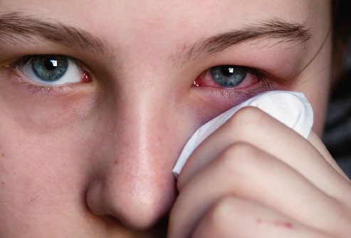 كيفية التخلص من أمراض العين